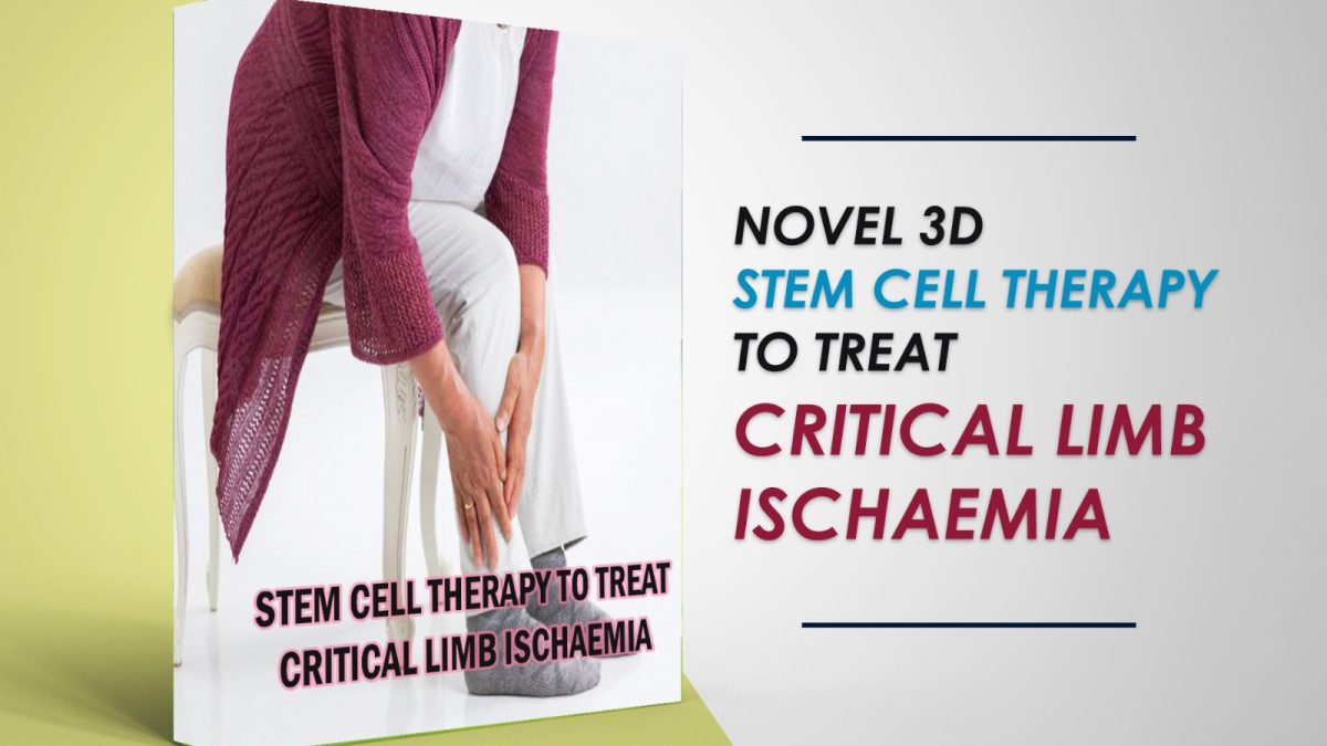 Novel 3D Stem Cell Therapy To Treat Critical Limb Ischaemia