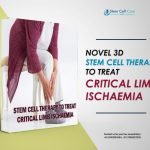 Novel 3D Stem Cell Therapy To Treat Critical Limb Ischaemia