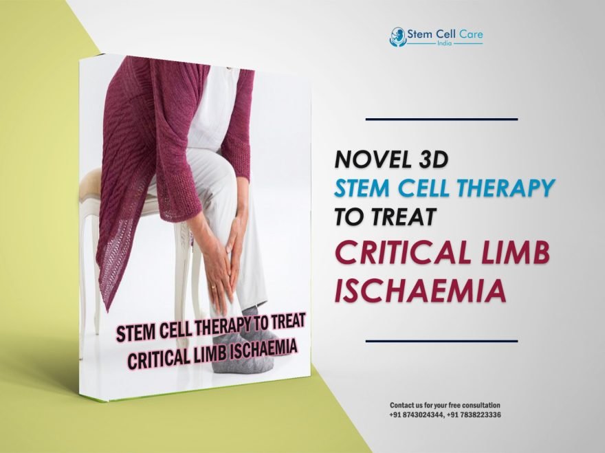 Novel 3D Stem Cell Therapy To Treat Critical Limb Ischaemia