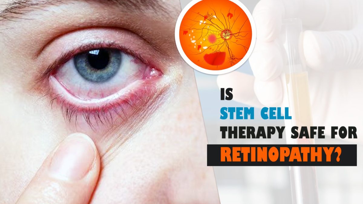 Is Stem Cell Therapy Safe for Retinopathy?