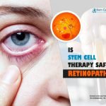 Is Stem Cell Therapy Safe for Retinopathy?