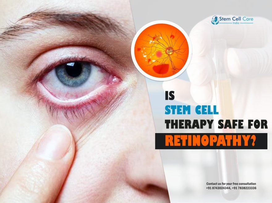 Is Stem Cell Therapy Safe for Retinopathy?