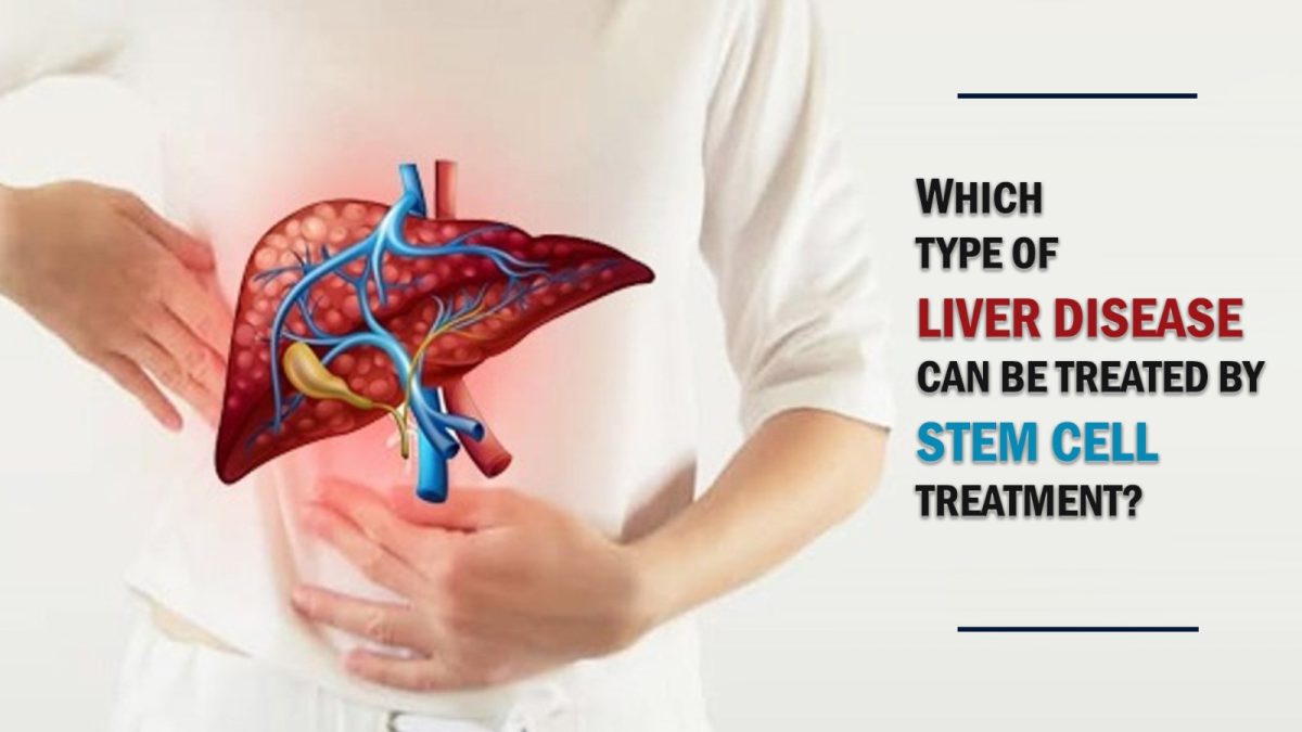 Which Type of Liver Disease Can Be Treated by Stem Cell Treatment?