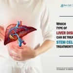 Which Type of Liver Disease Can Be Treated by Stem Cell Treatment?