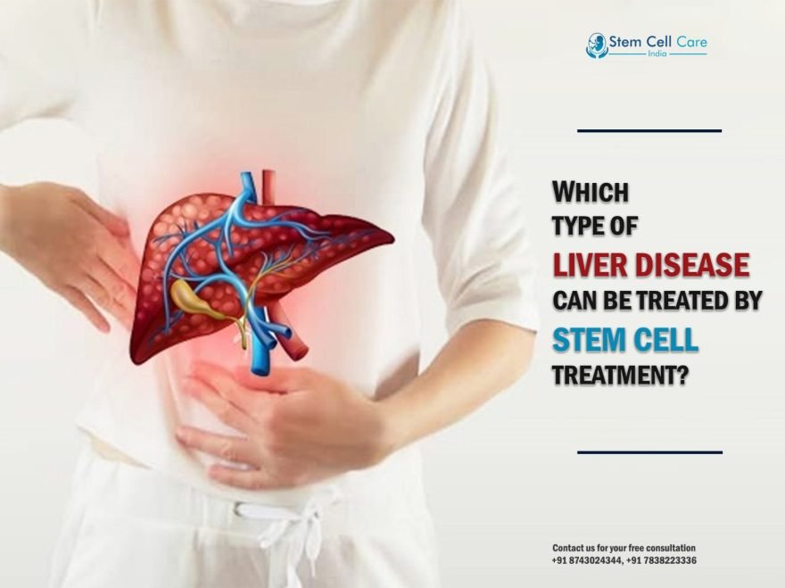 Which Type of Liver Disease Can Be Treated by Stem Cell Treatment?