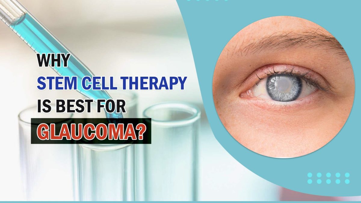 Why Stem Cell Therapy Is Best For Glaucoma?