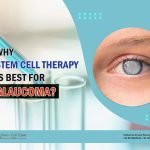 Why Stem Cell Therapy Is Best For Glaucoma?