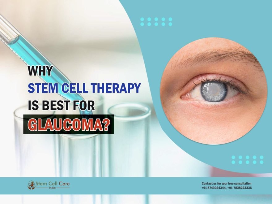 Why Stem Cell Therapy Is Best For Glaucoma?