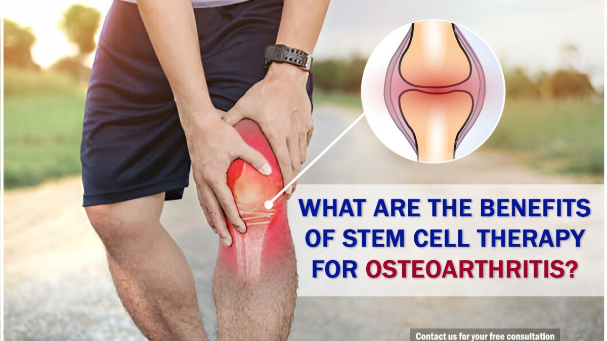 What Are the Benefits of Stem Cell Therapy for Osteoarthritis?