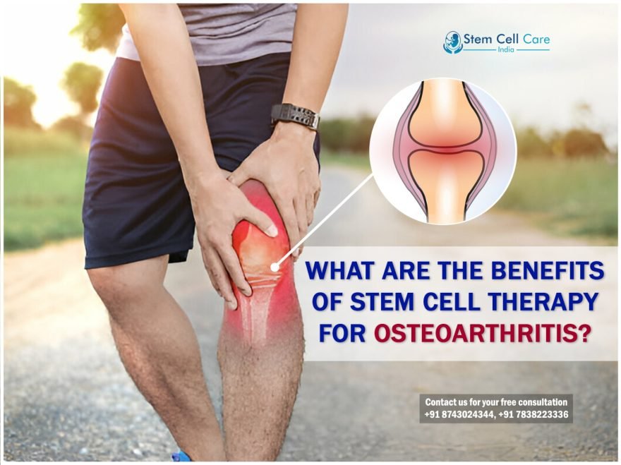 What Are the Benefits of Stem Cell Therapy for Osteoarthritis?