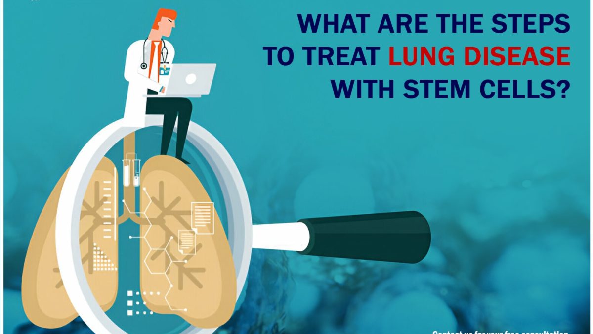 What Are the Steps to Treat Lung Disease with Stem Cells?