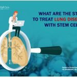 What Are the Steps to Treat Lung Disease with Stem Cells?