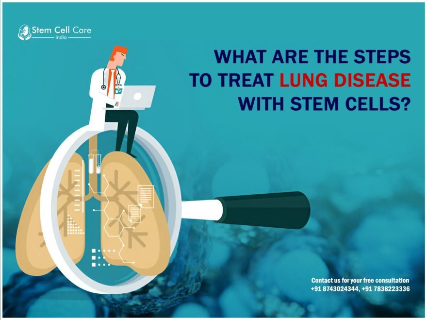 What Are the Steps to Treat Lung Disease with Stem Cells?