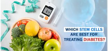 Which Stem Cells Are Best for Treating Diabetes?