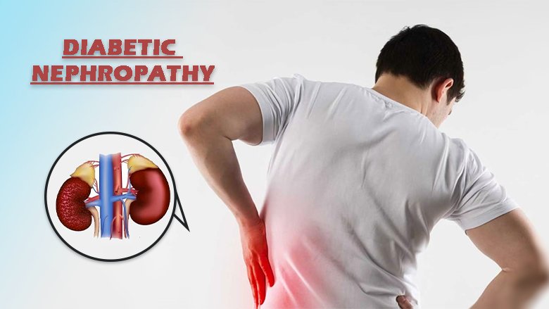 Exosome Treatment Diabetic Nephropathy