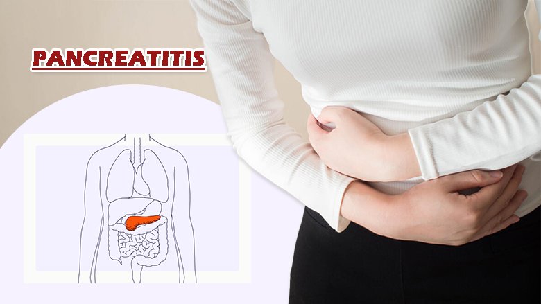 Pancreatitis Exosome Treatment For Pancreatitis