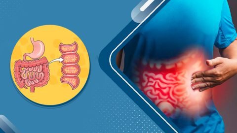Stem Cell Treatment for Crohn’s Disease in India
