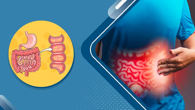 Stem Cell Treatment for Crohn’s Disease in India