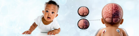 Stem Cell Treatment for Hypoxic Ischemic Encephalopathy