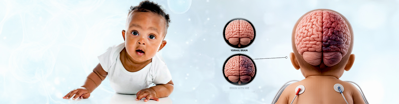 Stem Cell Treatment for Hypoxic Ischemic Encephalopathy