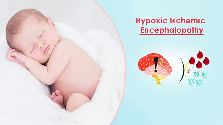 Stem Cell Treatment for Hypoxic Ischemic Encephalopathy