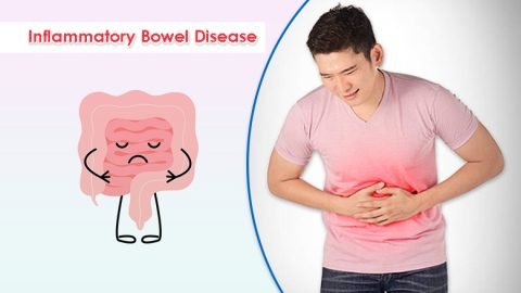 Stem Cell Treatment for Inflammatory Bowel Disease