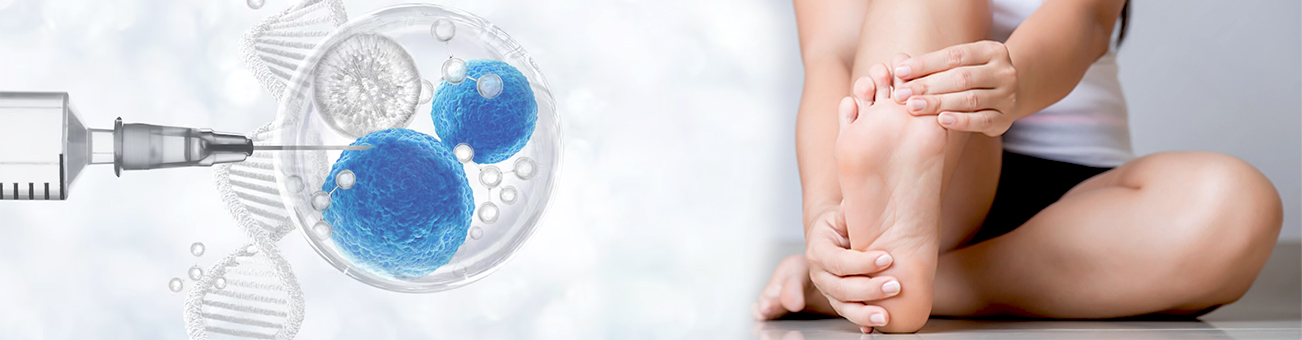 Stem Cell Treatment for Peripheral Neuropathy