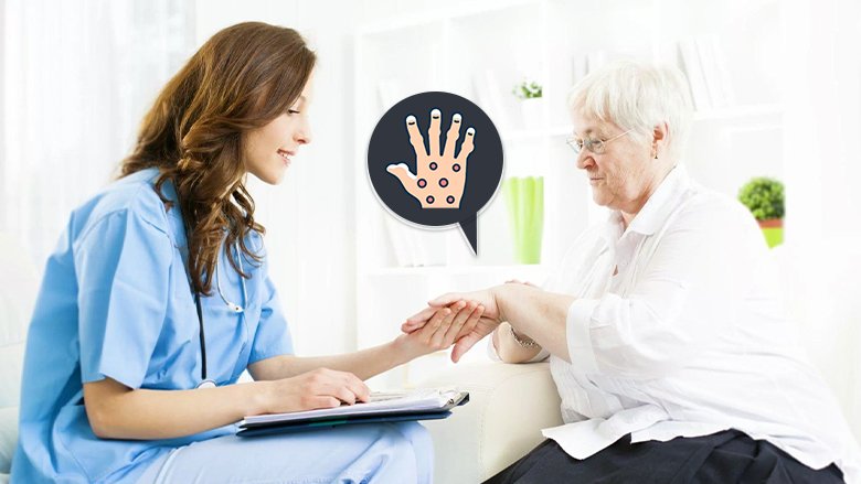 Stem Cell Treatment for Psoriasis