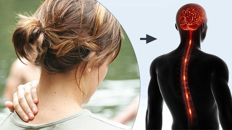 Stem Cell Treatment for Syringomyelia