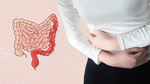 Stem Cell Treatment for Ulcerative Colitis
