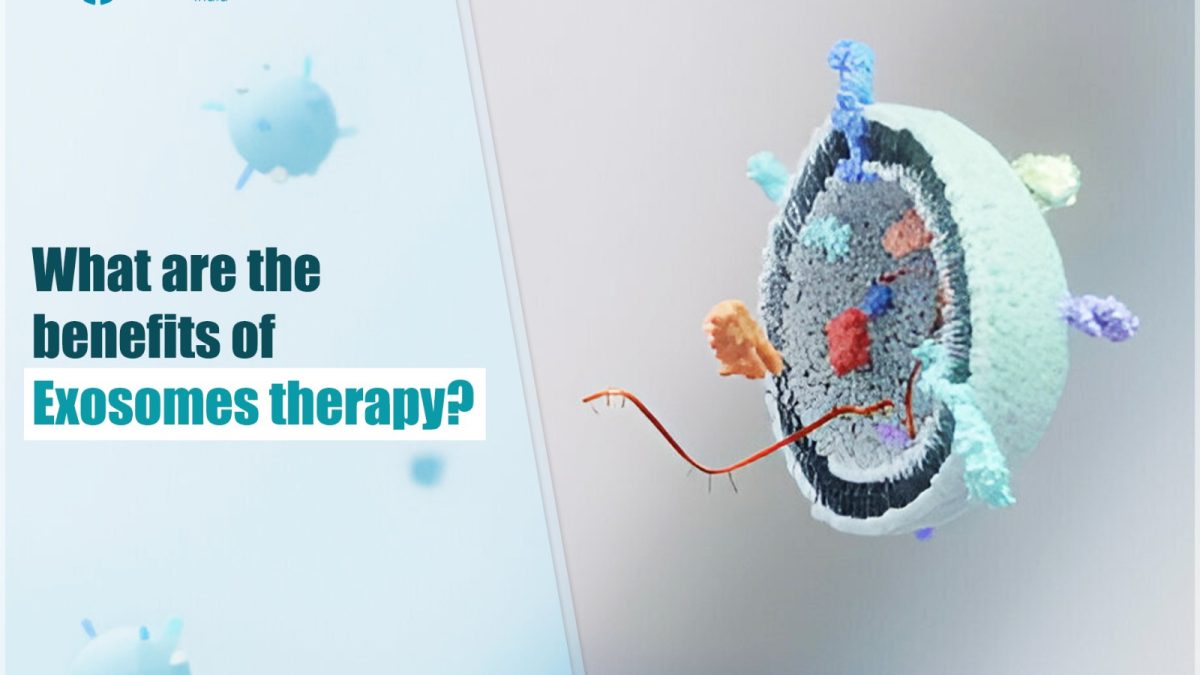 Exosomes Therapy