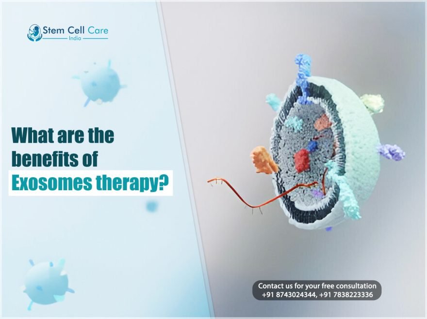 Exosomes Therapy