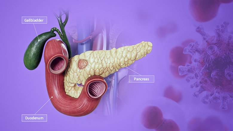 Immunotherapy for Pancreas Cancer in India