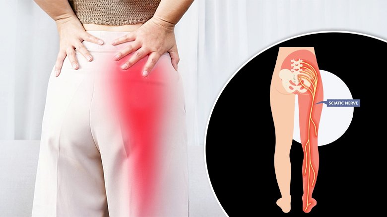 Sciatic Nerve Injury