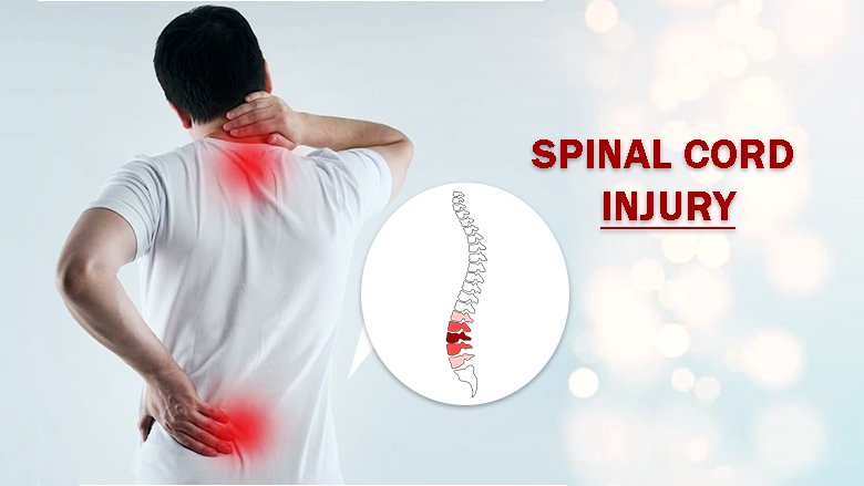 Spinal cord injury