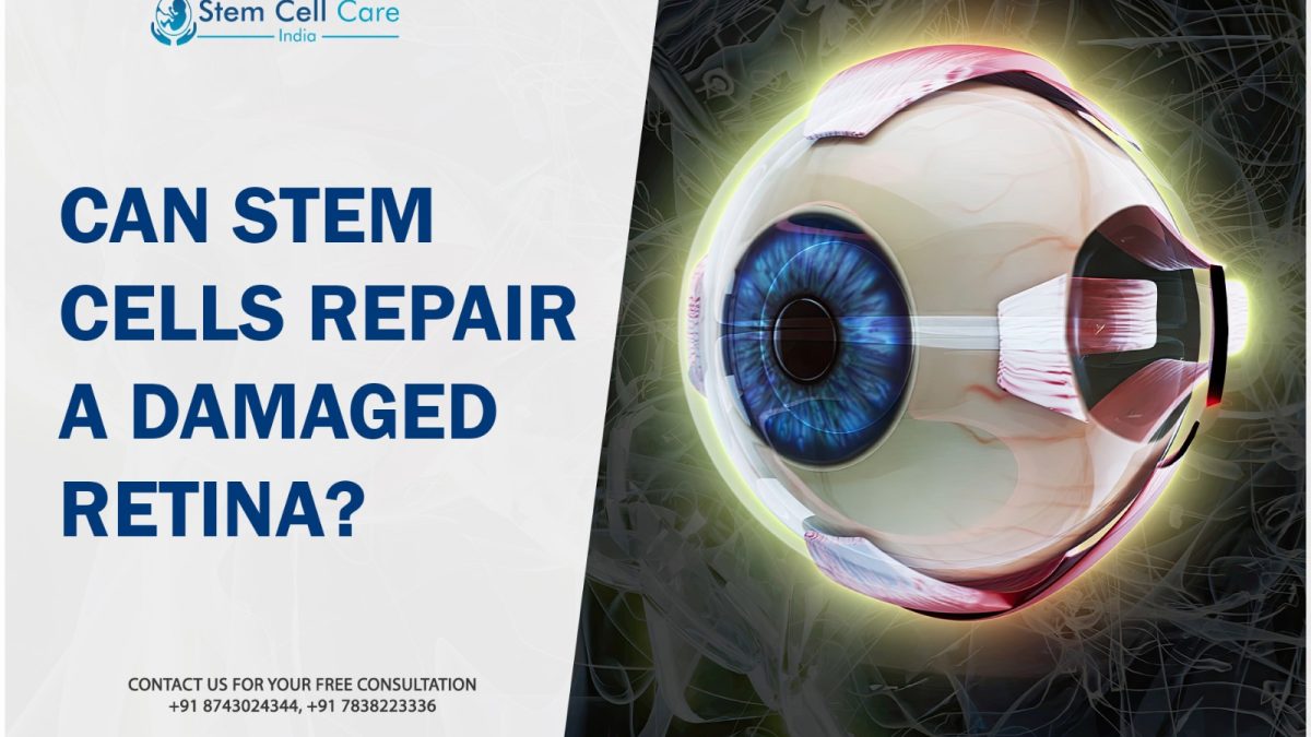 Can Stem Cells Repair a Damaged Retina?