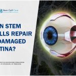 Can Stem Cells Repair a Damaged Retina?