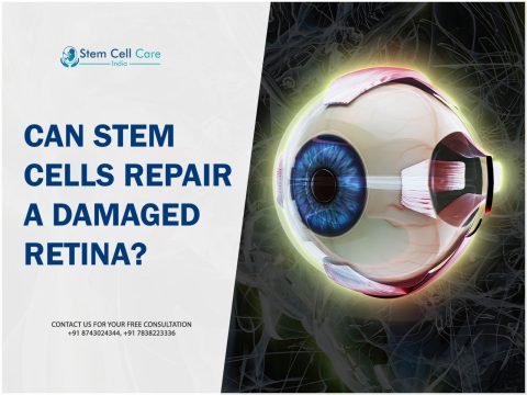 Can Stem Cells Repair a Damaged Retina?