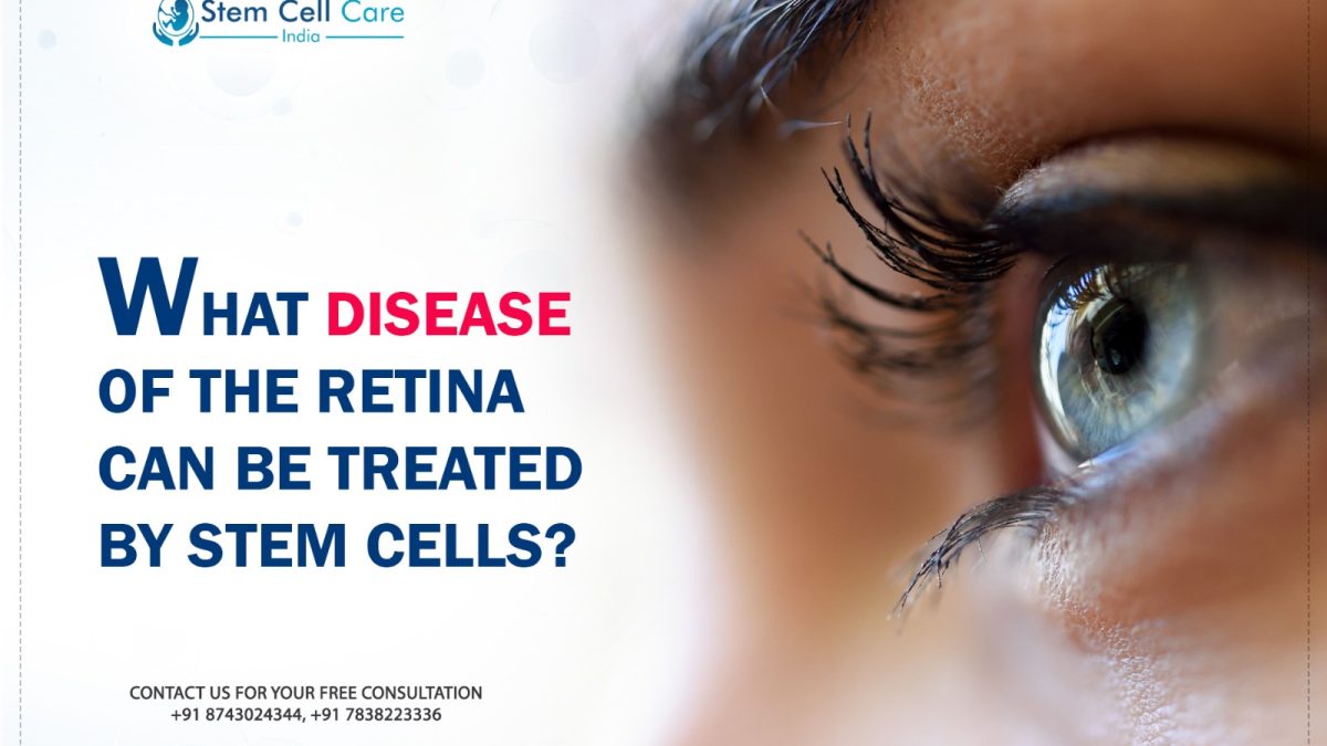 What Disease of the Retina Can be Treated By Stem Cells?