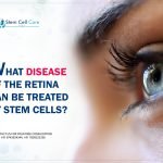 What Disease of the Retina Can be Treated By Stem Cells?