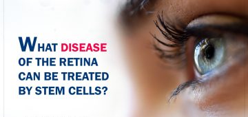 What Disease of the Retina Can be Treated By Stem Cells?