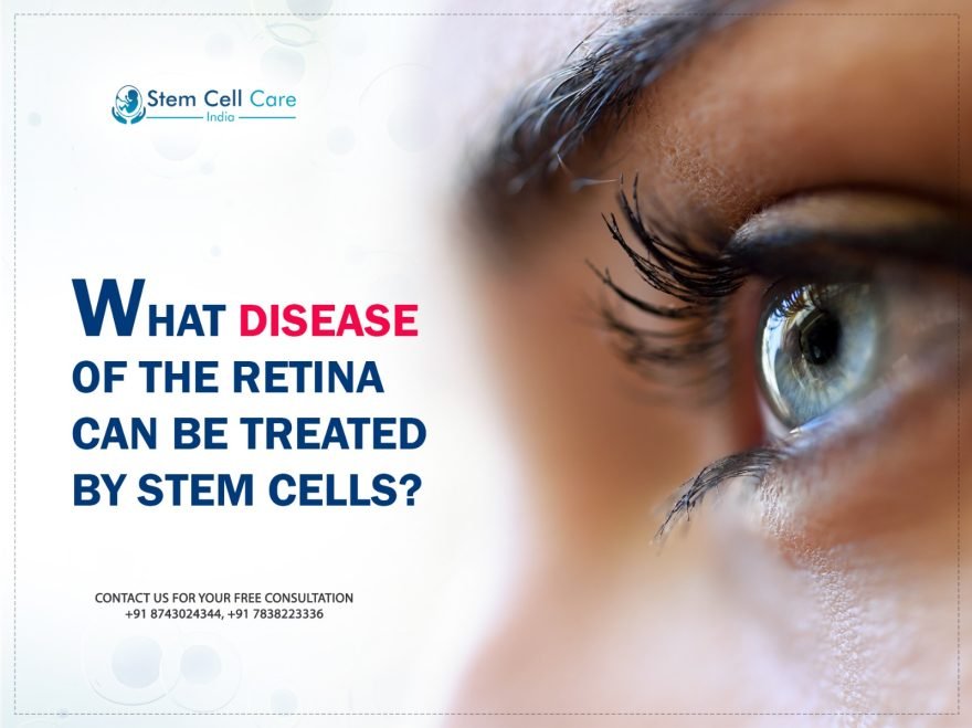 What Disease of the Retina Can be Treated By Stem Cells?