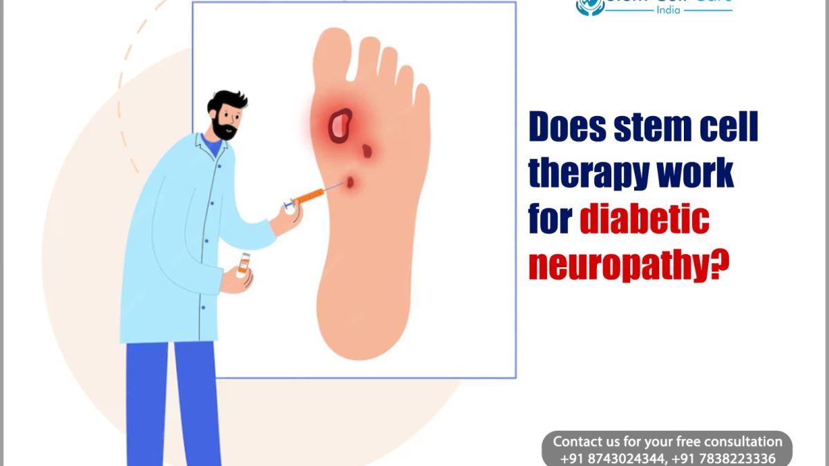 Does Stem Cell Therapy Work for Diabetic Neuropathy?