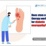 Does Stem Cell Therapy Work for Diabetic Neuropathy?