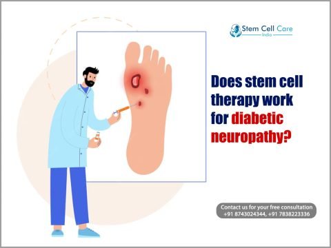 Does Stem Cell Therapy Work for Diabetic Neuropathy?