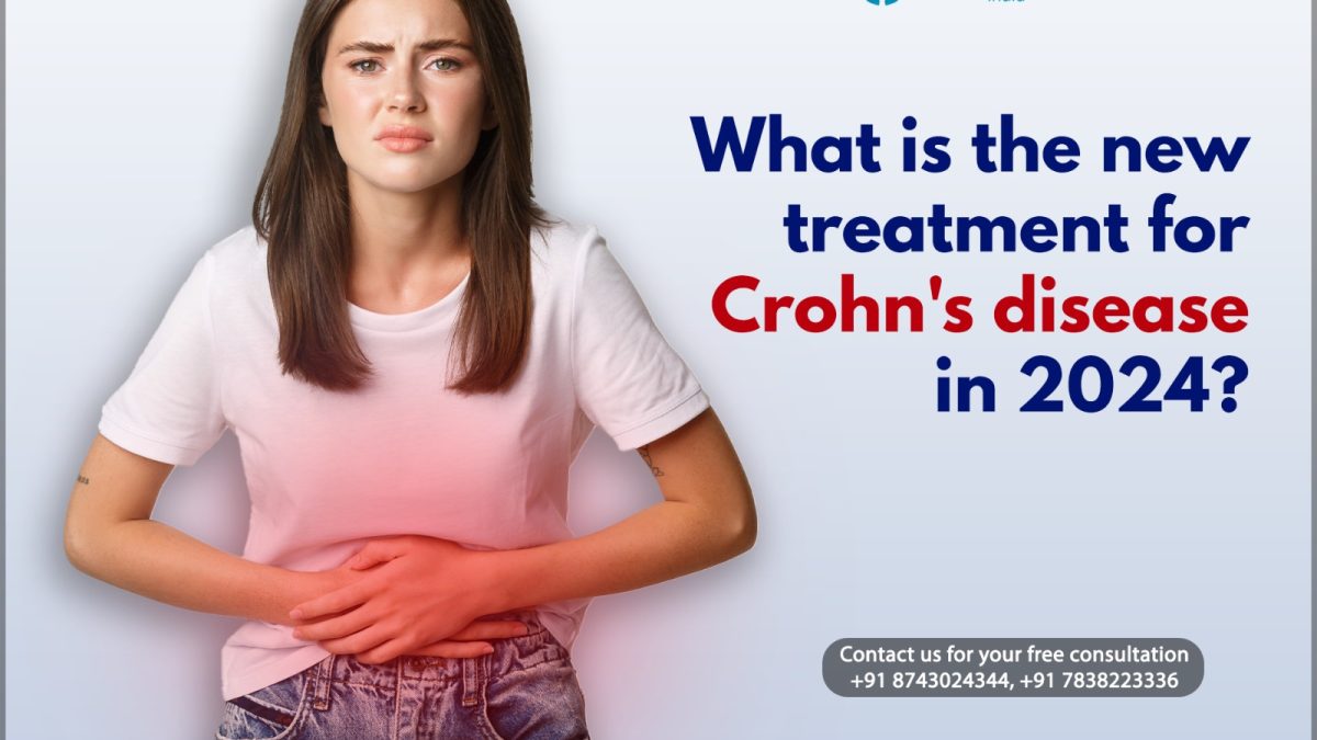 What Is the New Treatment for Crohn’s Disease in 2024?