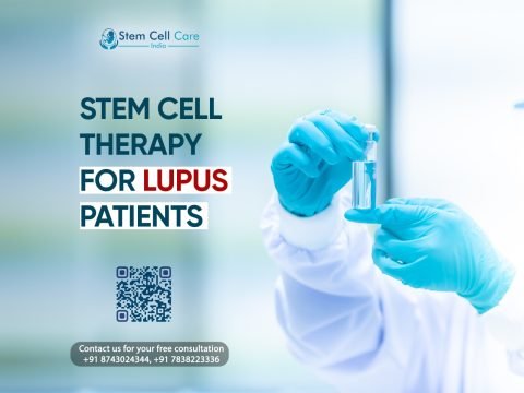 Stem Cell Therapy for Lupus Patients