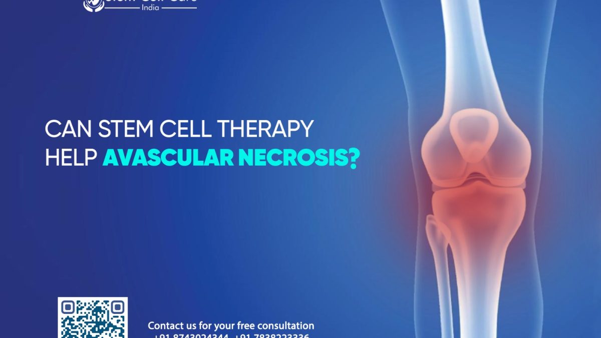 Can Stem Cell Therapy Help Avascular Necrosis?