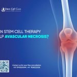 Can Stem Cell Therapy Help Avascular Necrosis?