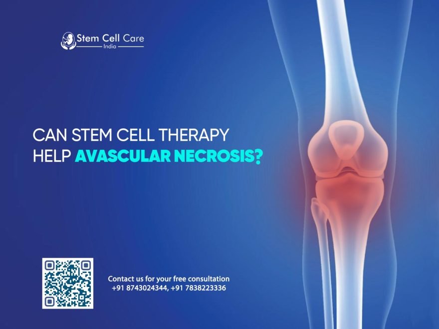 Can Stem Cell Therapy Help Avascular Necrosis?